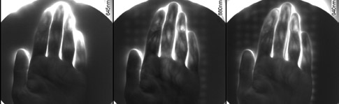 Rys. 3. Porównanie rezultatów prześwietlenia dłoniowej strony ręki lewej Rys. 3. Porównanie rezultatów prześwietlenia dłoniowej strony ręki lewej