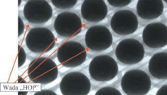 Fig. 4. Examples of solder joints of a BGA component observed on X-ray detector – HoP defect