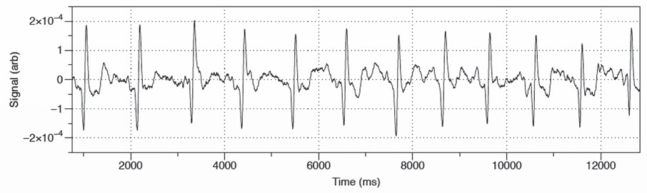 Rys. 4. Zapis magnetokardiogramu. Fig. 4. Magnetocardiogram