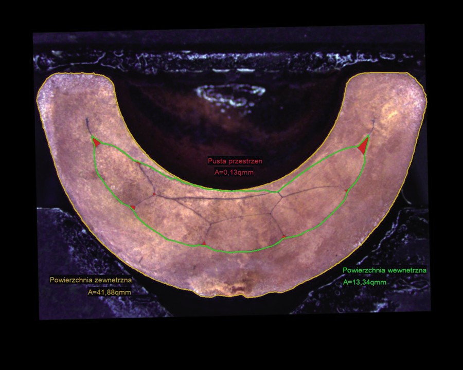 Końcówka standardowa 25mm2 zaciśnięta na żyle RMC 25mm2 za pomocą matrycy z głębokim karbem Końcówka standardowa 25mm2 zaciśnięta na żyle RMC 25mm2 za pomocą matrycy z głębokim karbem