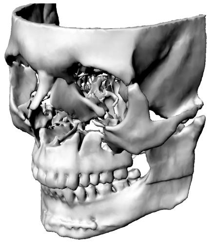 Model twarzoczaszki 3D