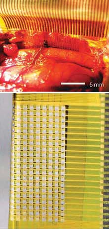 Matryca ultracienkich elektrod (na górze umieszczona w mózgu kota) pozwalająca na gromadzenie znacznie większej ilości danych niż dotychczas. Matryca jest tak cienka i elastyczna, że można umieścić na bardzo cienkich i nierównych powierzchniach.